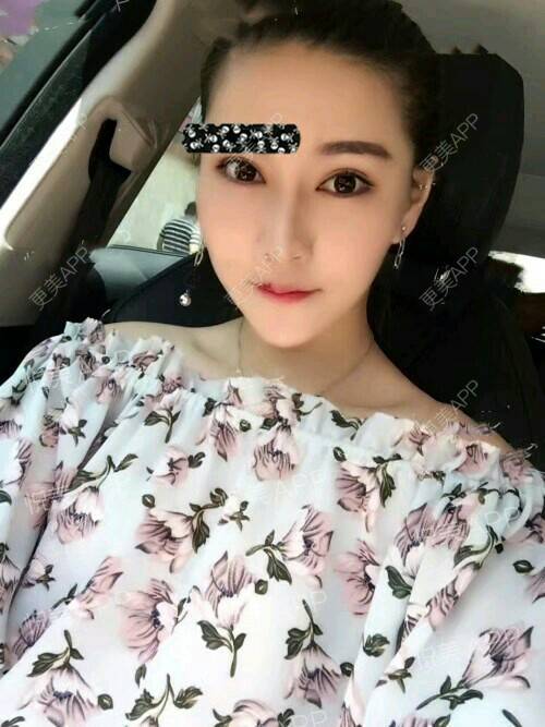 更美 - 吴云 医生的经验 | 杭州