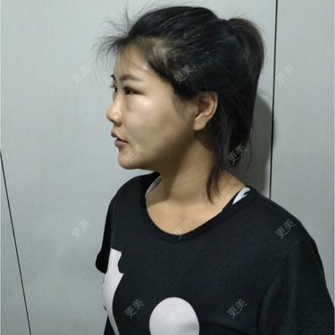 bug女