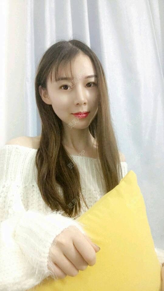 更美 - xNz3B婷的歪鼻矫正经验 | 上海 | 歪鼻矫正
