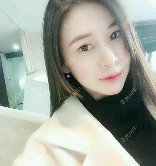 更美 - xNz3B婷的歪鼻矫正经验 | 上海 | 歪鼻矫正