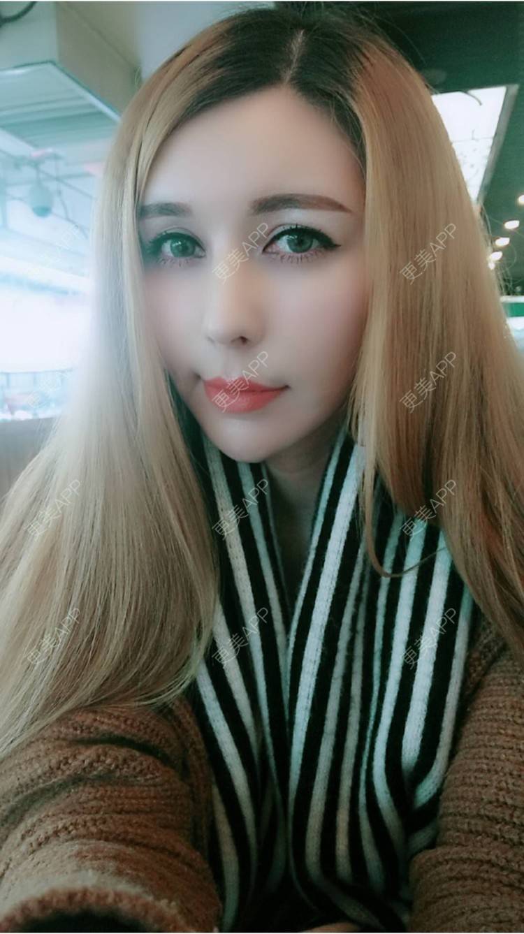 更美 - 菠萝菠萝蜜i的经验 | 纳米自体脂肪面部填充 | 重庆