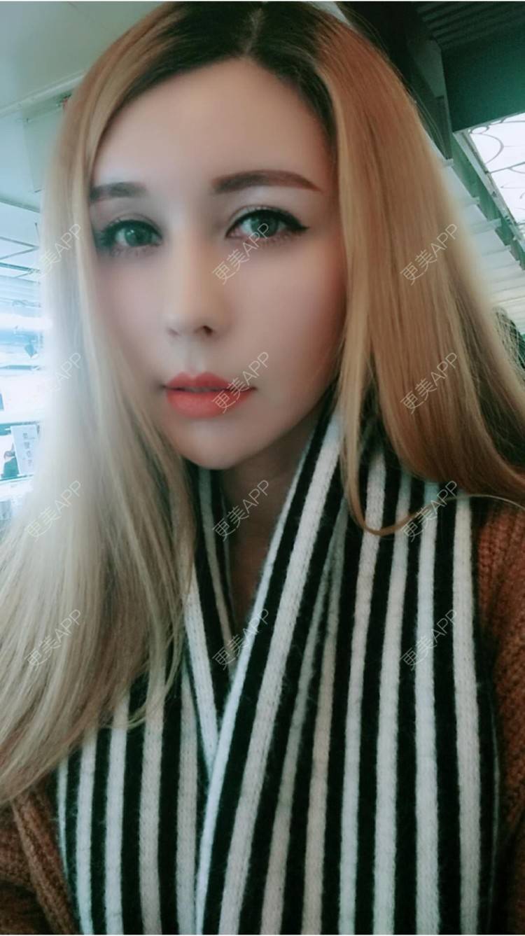 更美 - 菠萝菠萝蜜i的经验 | 纳米自体脂肪面部填充 | 重庆