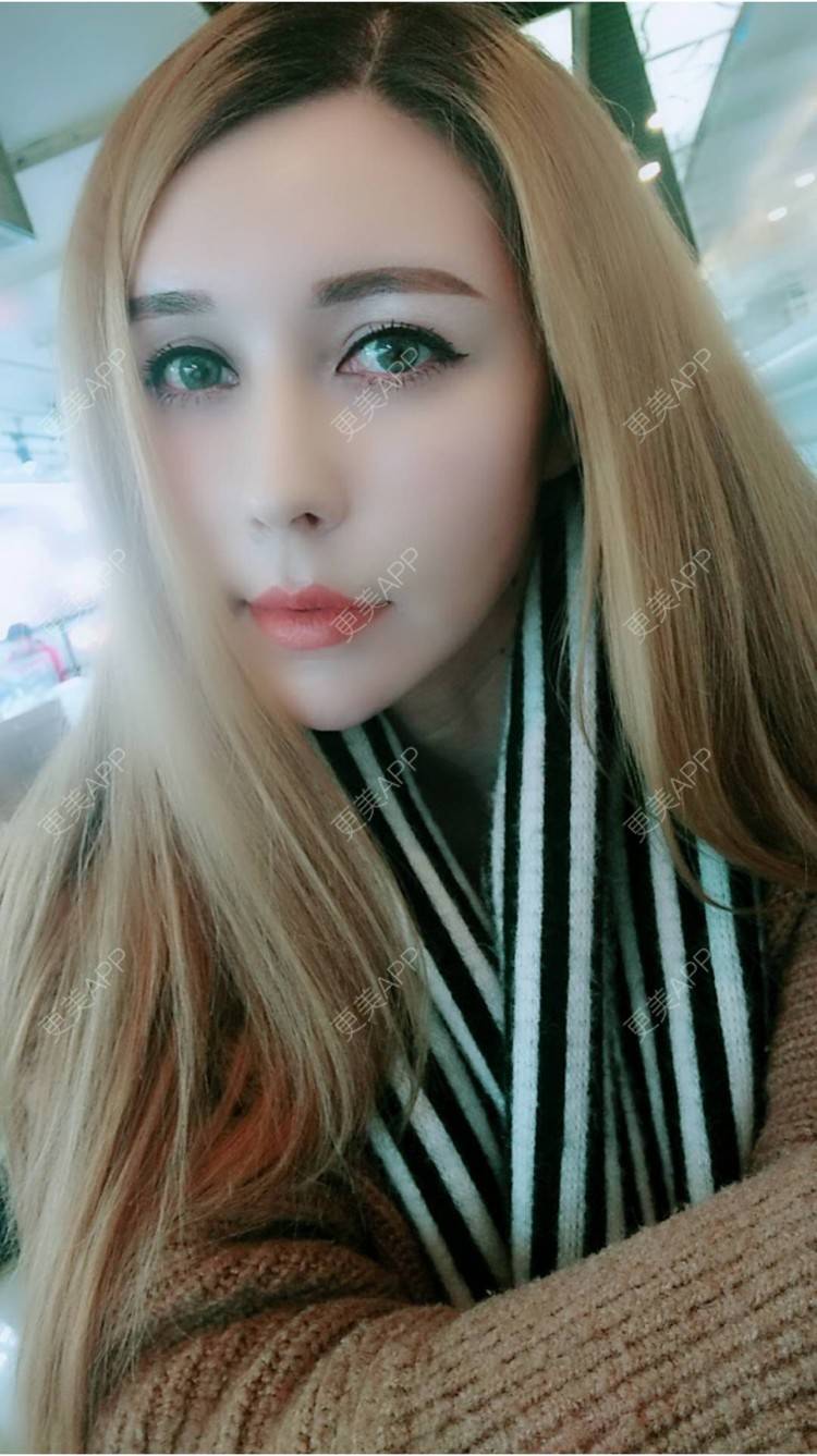 更美 - 菠萝菠萝蜜i的经验 | 纳米自体脂肪面部填充 | 重庆