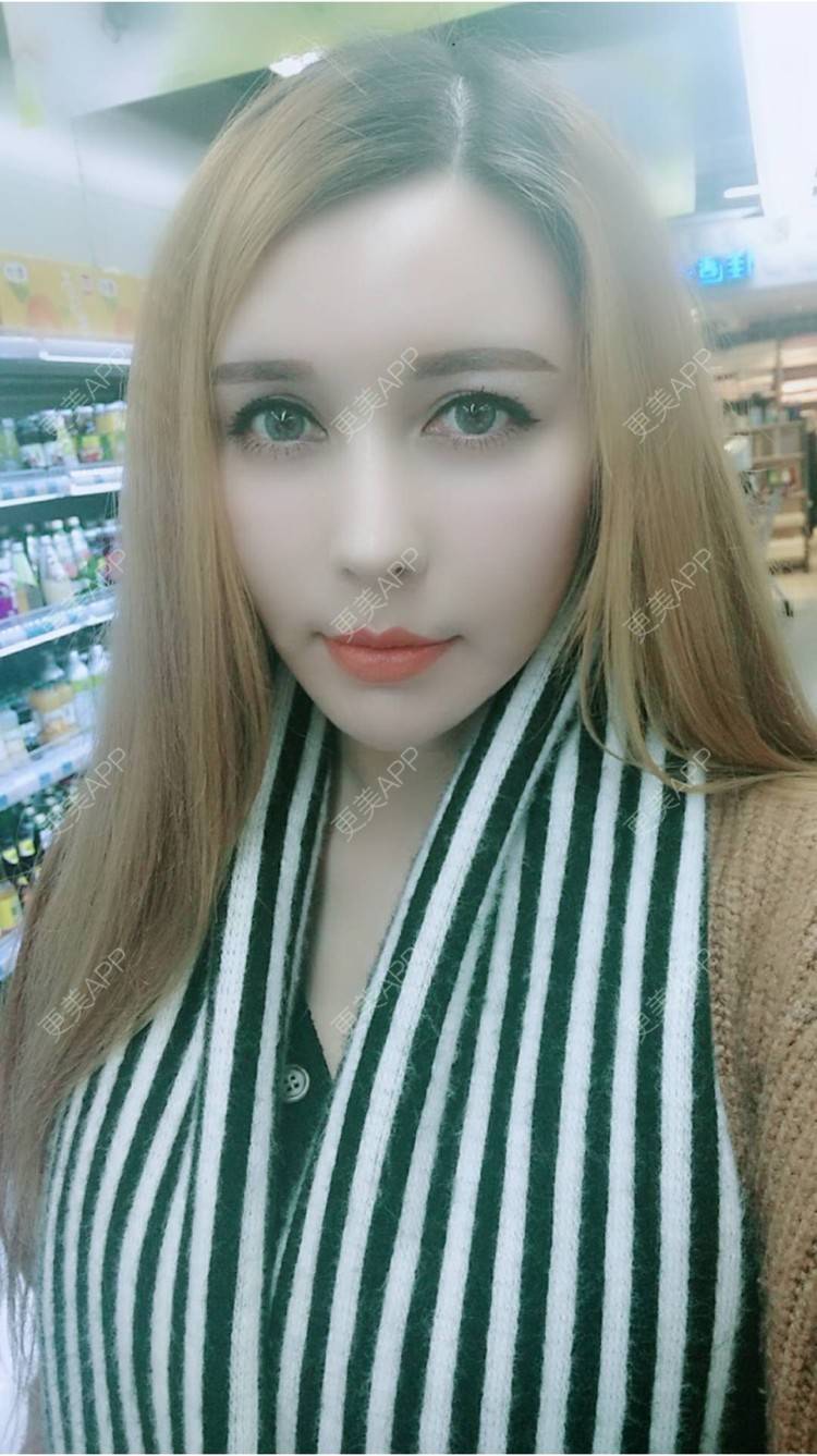 更美 - 菠萝菠萝蜜i的经验 | 纳米自体脂肪面部填充 | 重庆