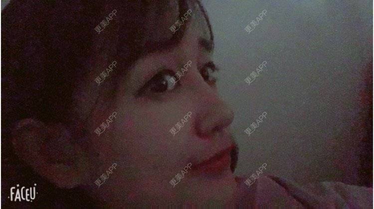 更美 - 匆匆1108的全脸整形套餐经验 | 鼻部整形 | 全脸整形套餐 | 武汉 | 隆鼻
