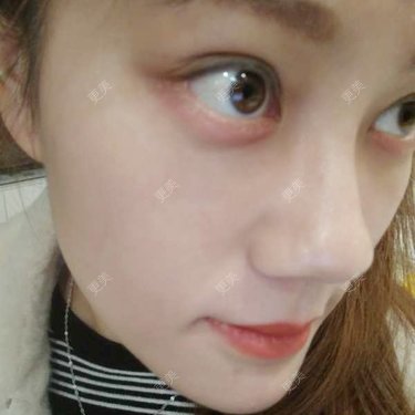 玻璃之情