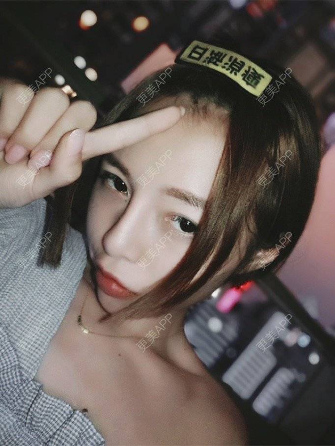 更美 - liu Lisa的鼻部多项经验 | 成都 | 鼻综合手术 | 隆鼻修复
