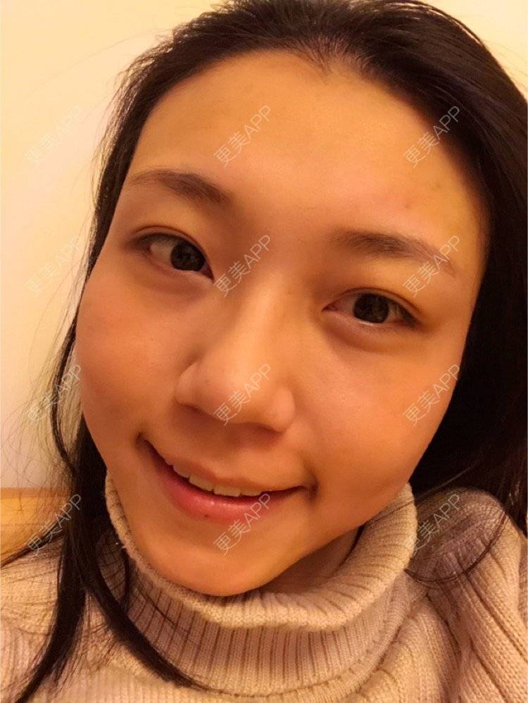 更美 - 会发光的鸟的像素激光经验 | 像素激光 | 视频日记 | 广州