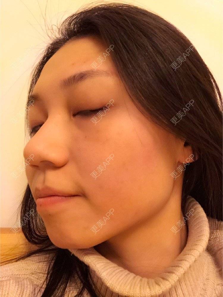更美 - 会发光的鸟的像素激光经验 | 像素激光 | 视频日记 | 广州