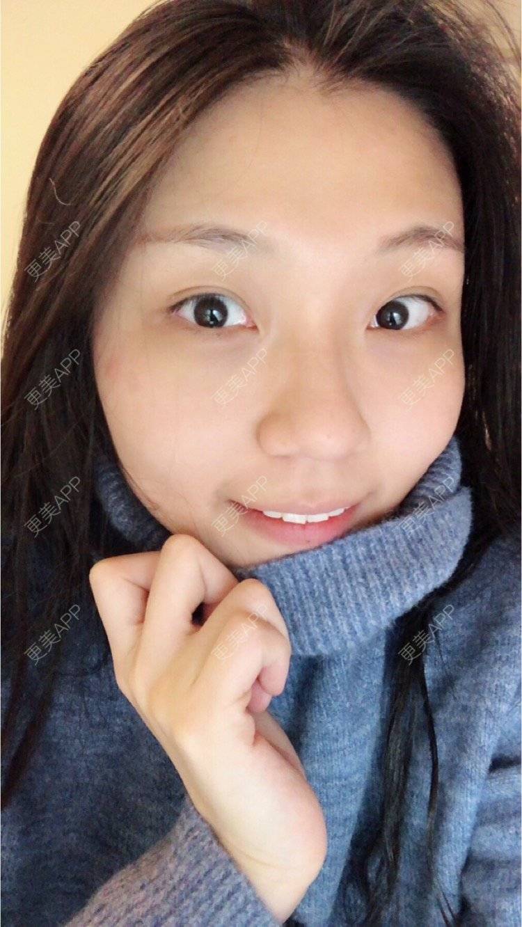 更美 - 会发光的鸟的像素激光经验 | 像素激光 | 视频日记 | 广州