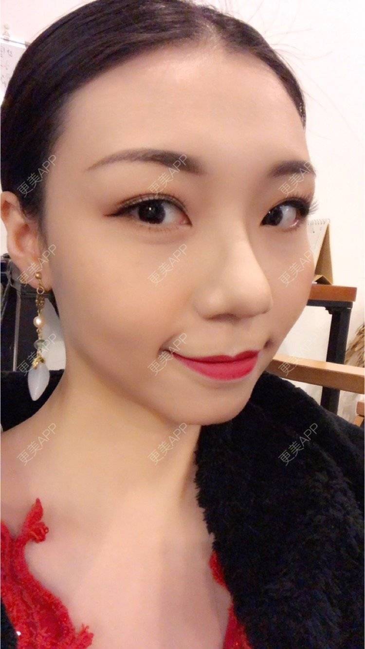 更美 - 会发光的鸟的像素激光经验 | 像素激光 | 视频日记 | 广州
