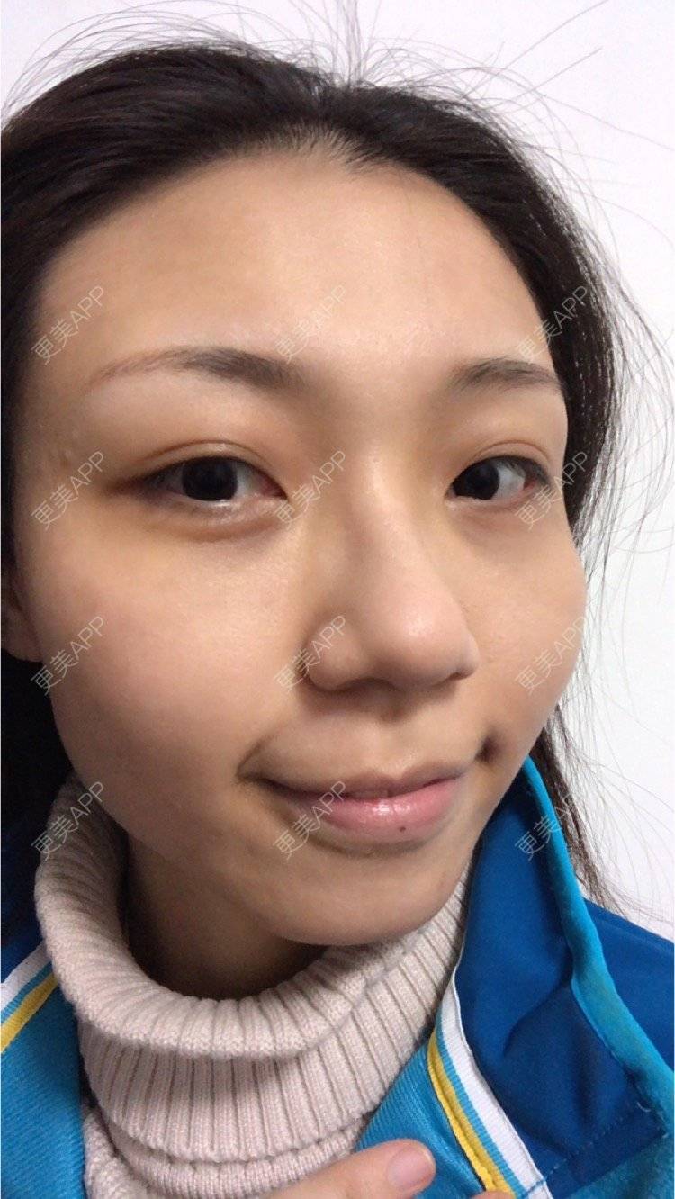 更美 - 会发光的鸟的像素激光经验 | 像素激光 | 视频日记 | 广州