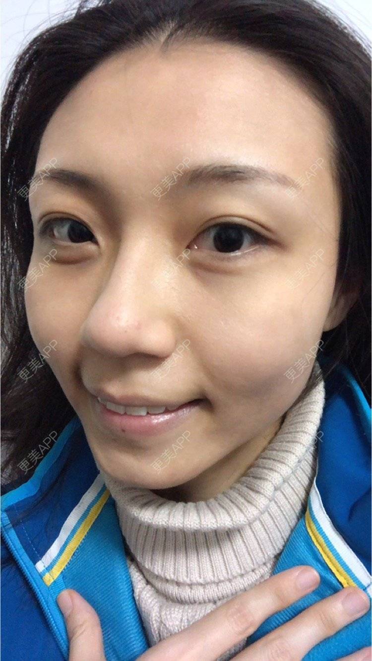 更美 - 会发光的鸟的像素激光经验 | 像素激光 | 视频日记 | 广州
