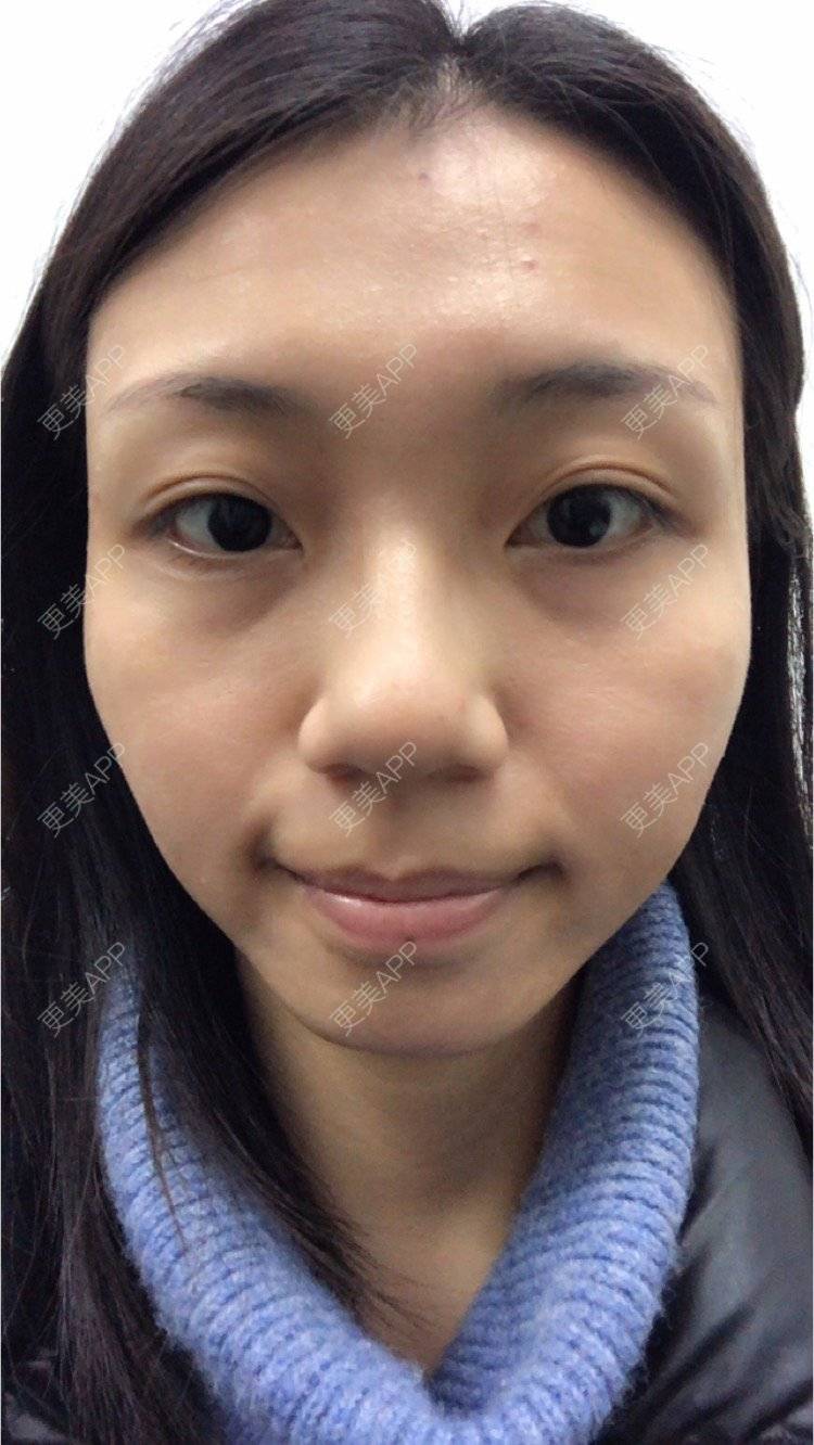 更美 - 会发光的鸟的像素激光经验 | 像素激光 | 视频日记 | 广州