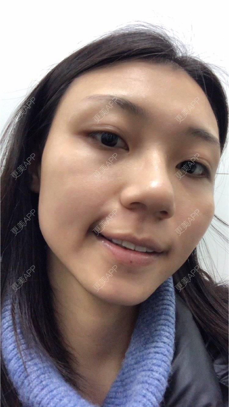 更美 - 会发光的鸟的像素激光经验 | 像素激光 | 视频日记 | 广州