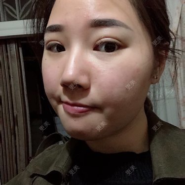 用桶喝水