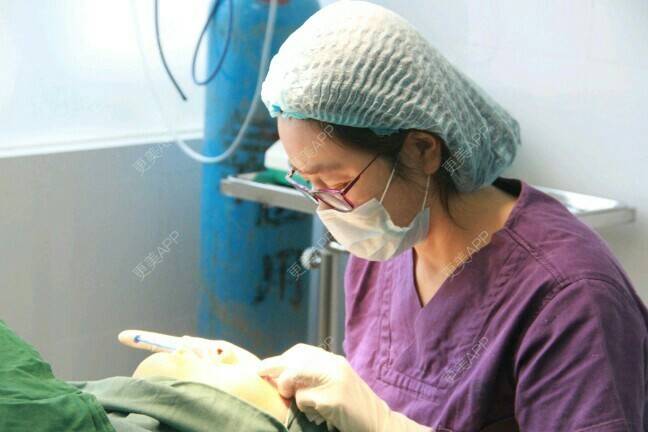 更美 - 更美用户BrpU6zP0GB的埋线双眼皮经验 | 厦门 | 埋线双眼皮