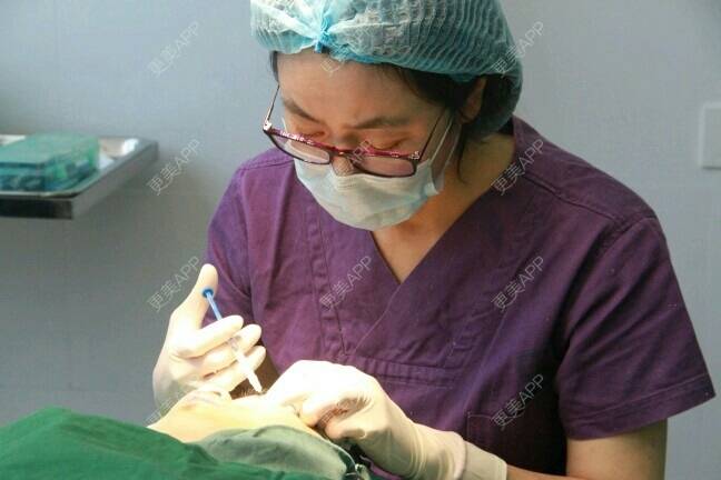 更美 - 更美用户BrpU6zP0GB的埋线双眼皮经验 | 厦门 | 埋线双眼皮