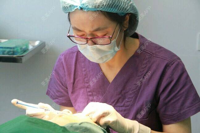 更美 - 更美用户BrpU6zP0GB的埋线双眼皮经验 | 厦门 | 埋线双眼皮