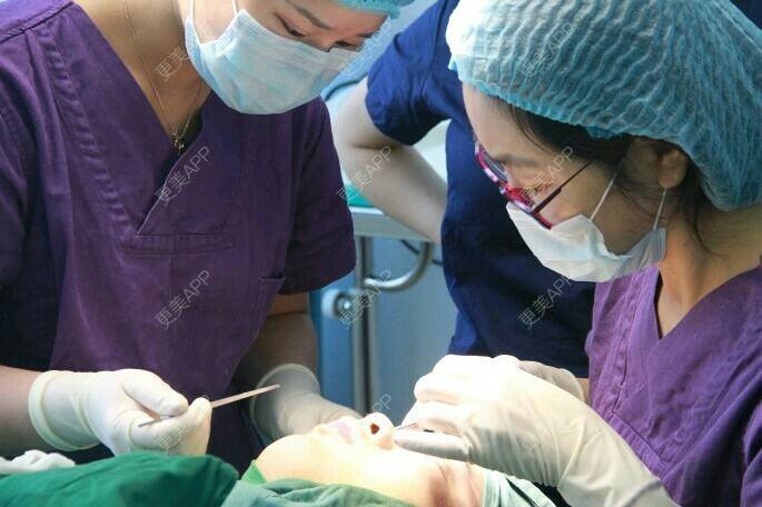 更美 - 更美用户BrpU6zP0GB的埋线双眼皮经验 | 厦门 | 埋线双眼皮