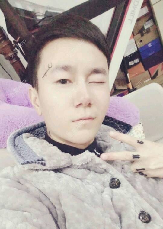 更美 - 承诺就像放屁，过后就没了的水光项目经验 | 鼻部多项 | 半永久妆 | 北京 | 水光项目 | 隆鼻 | 武汉 | 广州 | 牙贴面 | 深圳 | 牙齿矫正 | 成都 | 面部脱毛 | 自体脂肪面部年轻化 | 宁波 | 激光脱毛 | 重庆 | 埋线提升 | 光子嫩肤