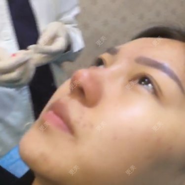 翟杨 医生