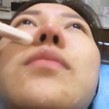 翟杨 医生