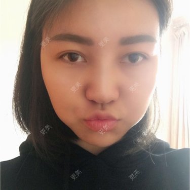 翟杨 医生