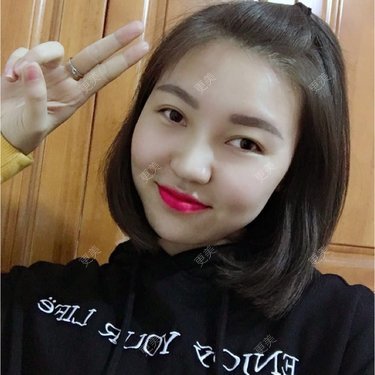 翟杨 医生
