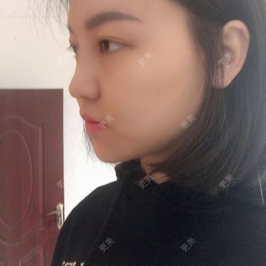 翟杨 医生