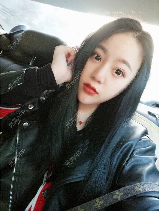 更美 - 妮妮小仙女的唇腭裂修复经验 | 玻尿酸唇部 | 重庆 | 丰唇珠