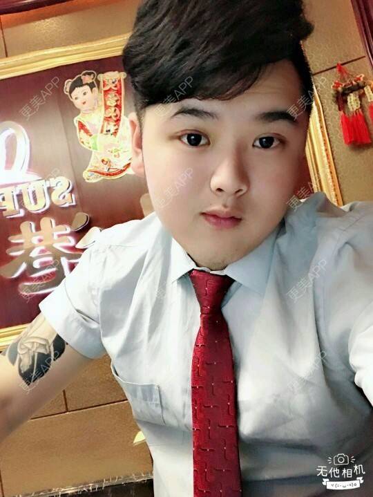 更美 - 更美用户BrpU6zP0GB的埋线双眼皮经验 | 厦门 | 埋线双眼皮