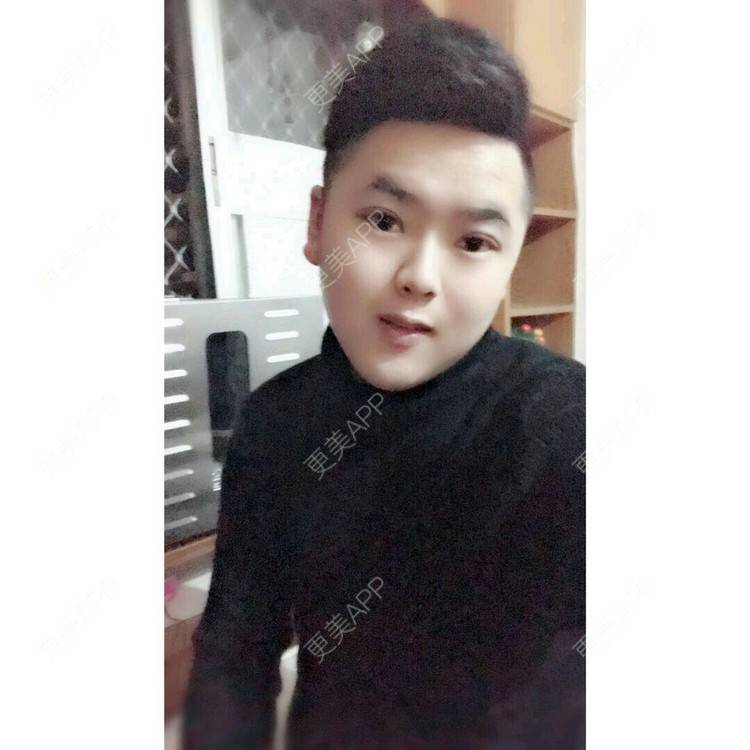 更美 - 更美用户BrpU6zP0GB的埋线双眼皮经验 | 厦门 | 埋线双眼皮