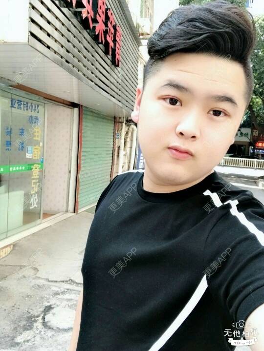 更美 - 更美用户BrpU6zP0GB的埋线双眼皮经验 | 厦门 | 埋线双眼皮