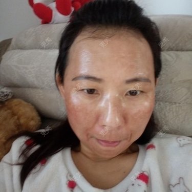 三骨伯安