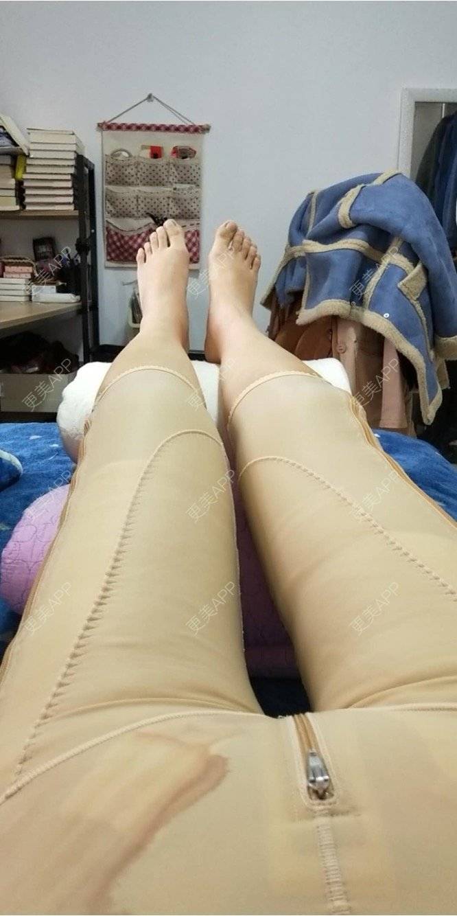 更美 - monkey1234的自体脂肪隆胸经验 | 成都 | 自体脂肪隆胸 | 视频日记