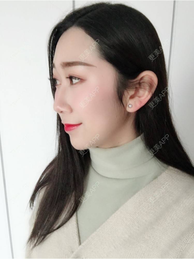 之前的照片还是蛮多感概的,不过还是觉得自己挺幸运的,留住这个下巴了