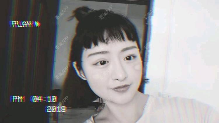 更美 - 米格m的鼻部多项经验 | 膨体隆鼻 | 广州 | 隆鼻 | 鼻部多项