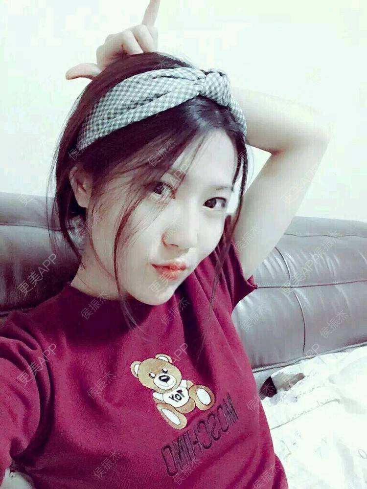 更美 - 更美用户e0XDIiDyP0的错颌锁颌经验 | 错颌锁颌 | 广州