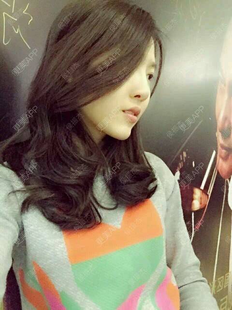 更美 - 更美用户e0XDIiDyP0的错颌锁颌经验 | 错颌锁颌 | 广州