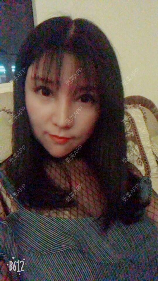 更美 - 更美用户cuJZLDzBlB的埋线提升经验 | 埋线提升 | 埋线除皱 | 武汉