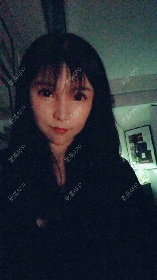 更美 - 更美用户cuJZLDzBlB的埋线提升经验 | 全脸整形套餐 | 埋线除皱 | 武汉 | 埋线提升