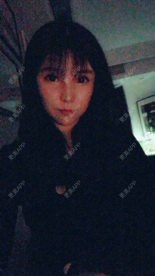 更美 - 更美用户cuJZLDzBlB的埋线提升经验 | 全脸整形套餐 | 埋线除皱 | 武汉 | 埋线提升