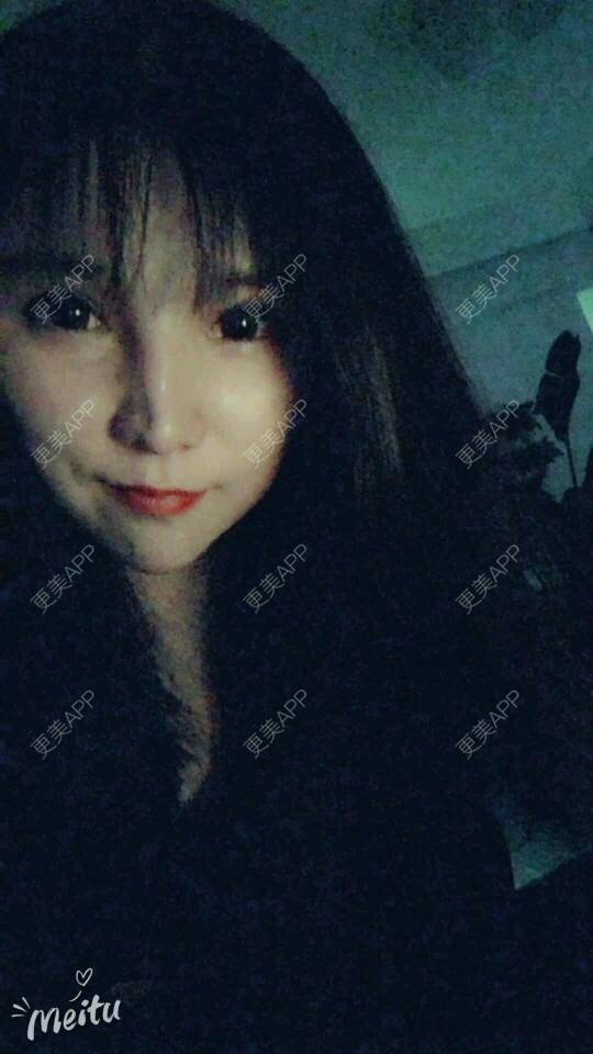 更美 - 更美用户cuJZLDzBlB的埋线提升经验 | 全脸整形套餐 | 埋线除皱 | 武汉 | 埋线提升