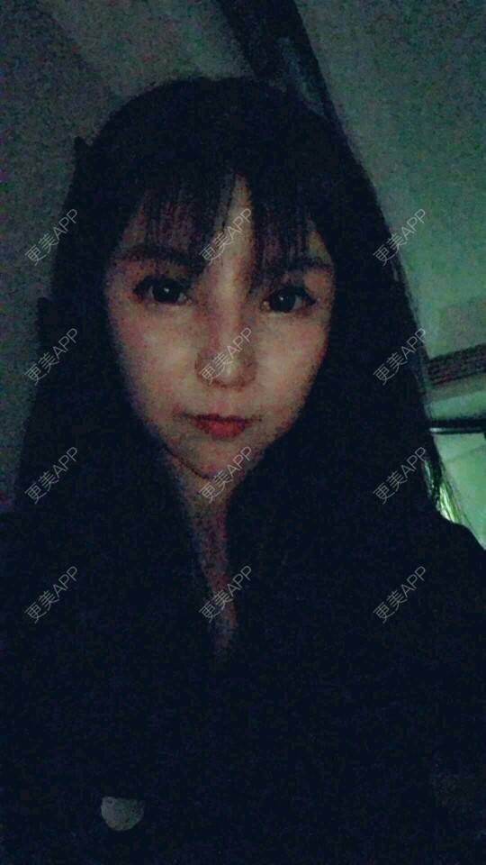 更美 - 更美用户cuJZLDzBlB的埋线提升经验 | 全脸整形套餐 | 埋线除皱 | 武汉 | 埋线提升