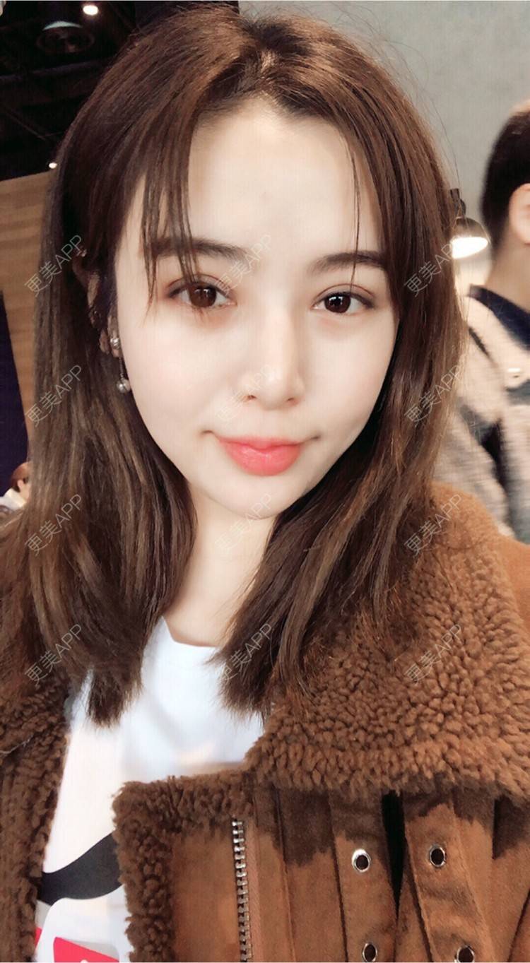 rainbowli的全切双眼皮日记