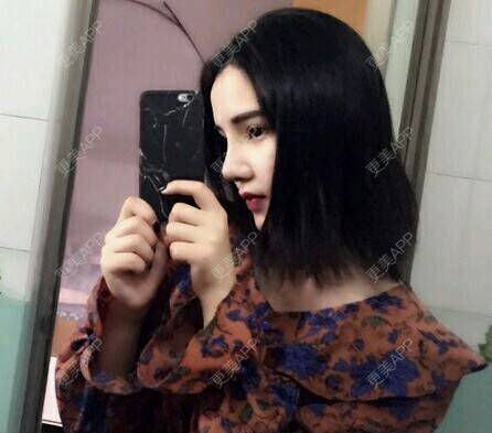 更美 - 宋宋弟弟的鼻部多项经验 | 激光紧缩阴道 | V脸套餐 | 水光项目 | 唇综合 | 隆鼻 | 鼻部多项 | 吸脂 | 注射塑形腿部 | 面部脱毛 | 激光脱毛 | 祛眼袋 | 除皱瘦脸 | 埋线提升 | 假体隆胸 | 小气泡 | 女性私密 | 广州