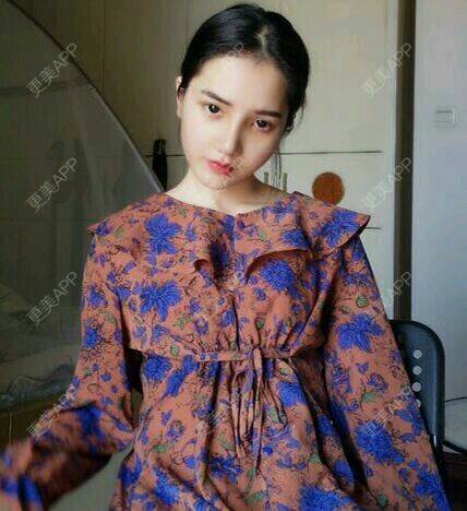 更美 - 宋宋弟弟的鼻部多项经验 | 激光紧缩阴道 | V脸套餐 | 水光项目 | 唇综合 | 隆鼻 | 鼻部多项 | 吸脂 | 注射塑形腿部 | 面部脱毛 | 激光脱毛 | 祛眼袋 | 除皱瘦脸 | 埋线提升 | 假体隆胸 | 小气泡 | 女性私密 | 广州