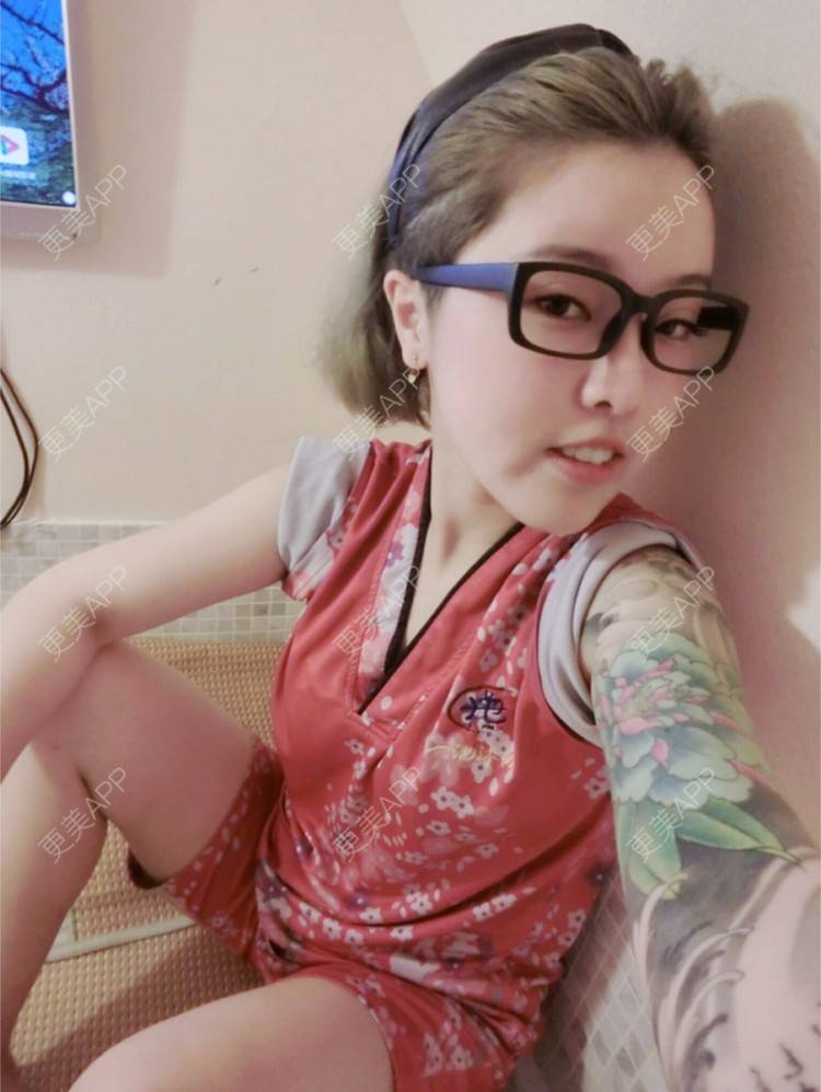 更美 - Joni小小板娘的射频溶脂瘦手臂经验 | 上海 | 射频溶脂瘦手臂 | 视频日记