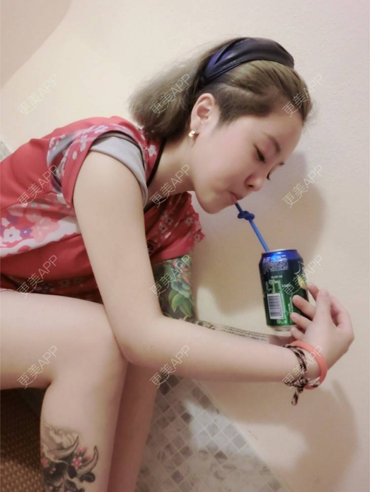 更美 - Joni小小板娘的射频溶脂瘦手臂经验 | 上海 | 射频溶脂瘦手臂 | 视频日记